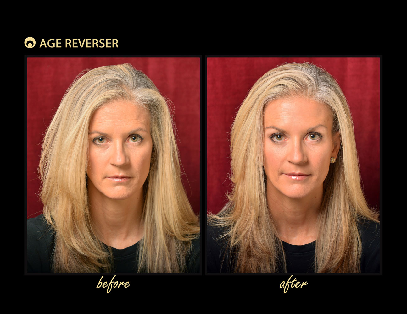 Age Reverser Facelift Band