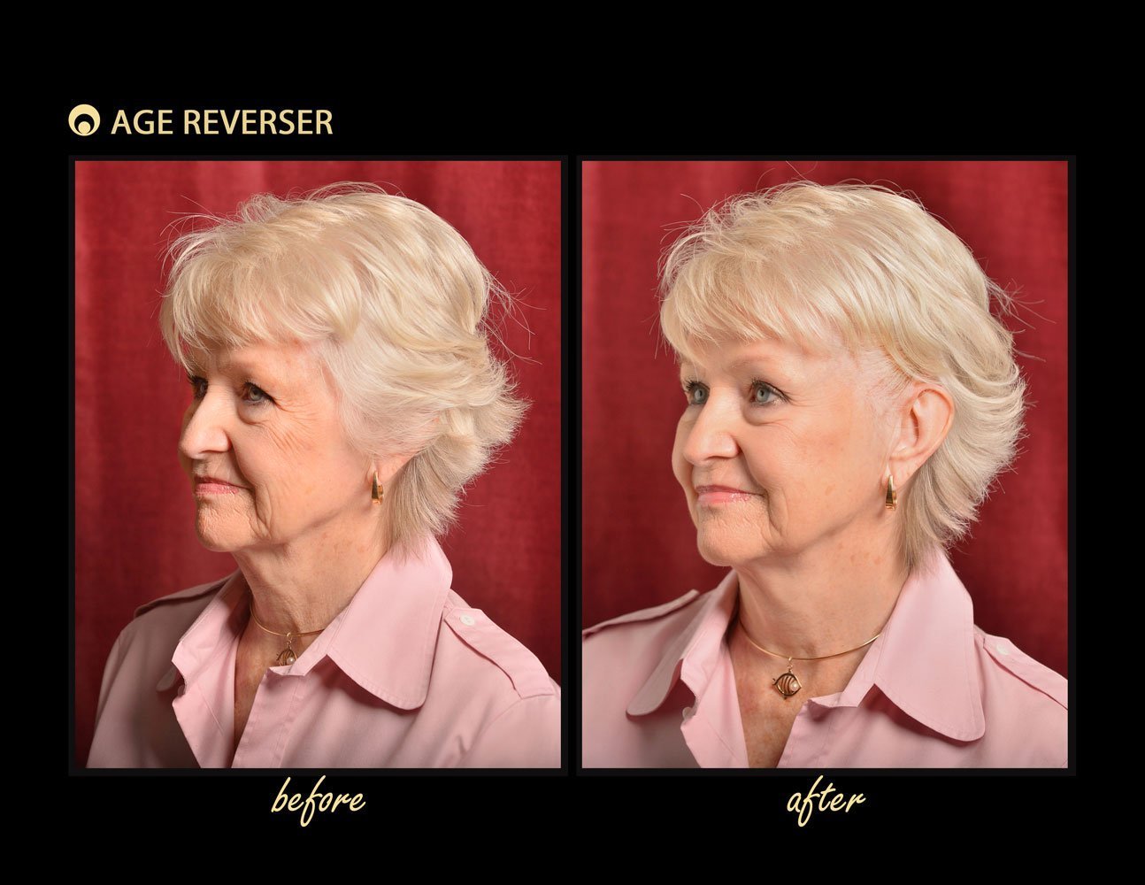 Age Reverser Facelift Band