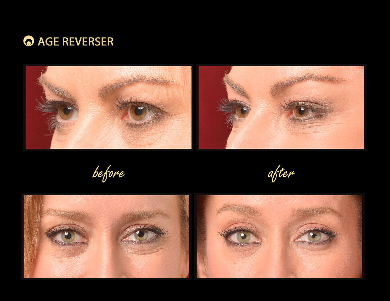 Age Reverser Facelift Band