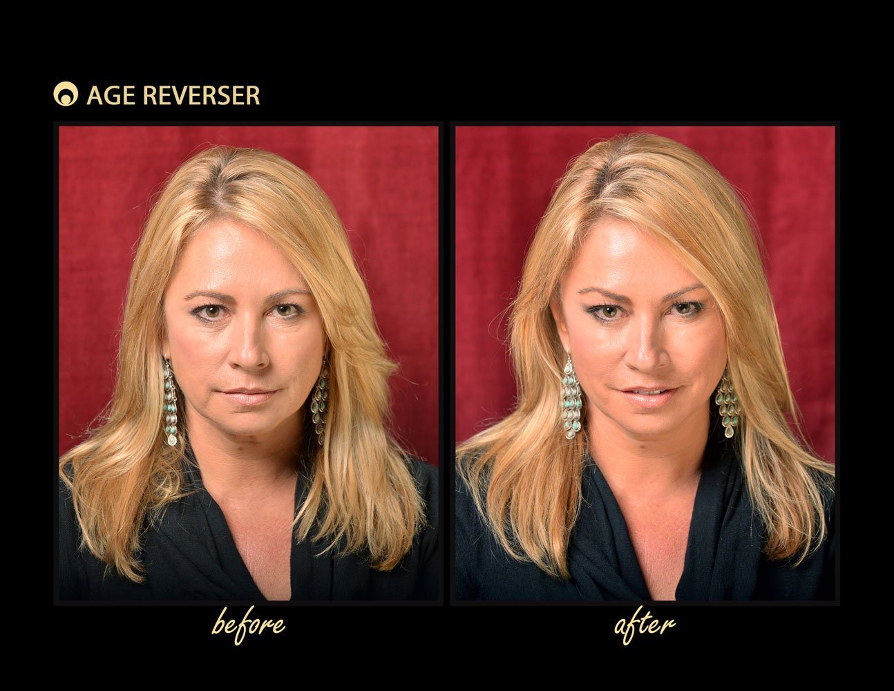 Age Reverser Facelift Band