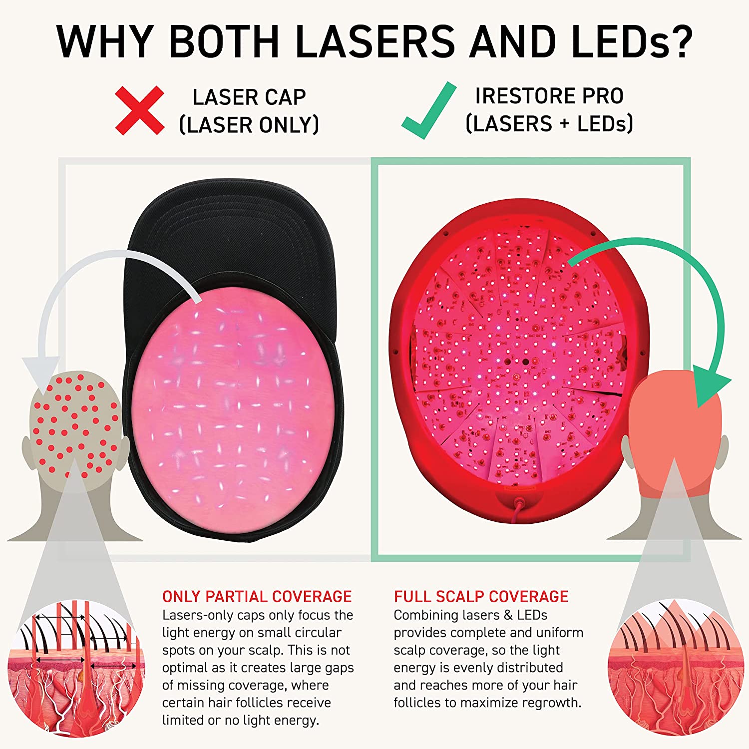 iRestore Laser Hair Growth System