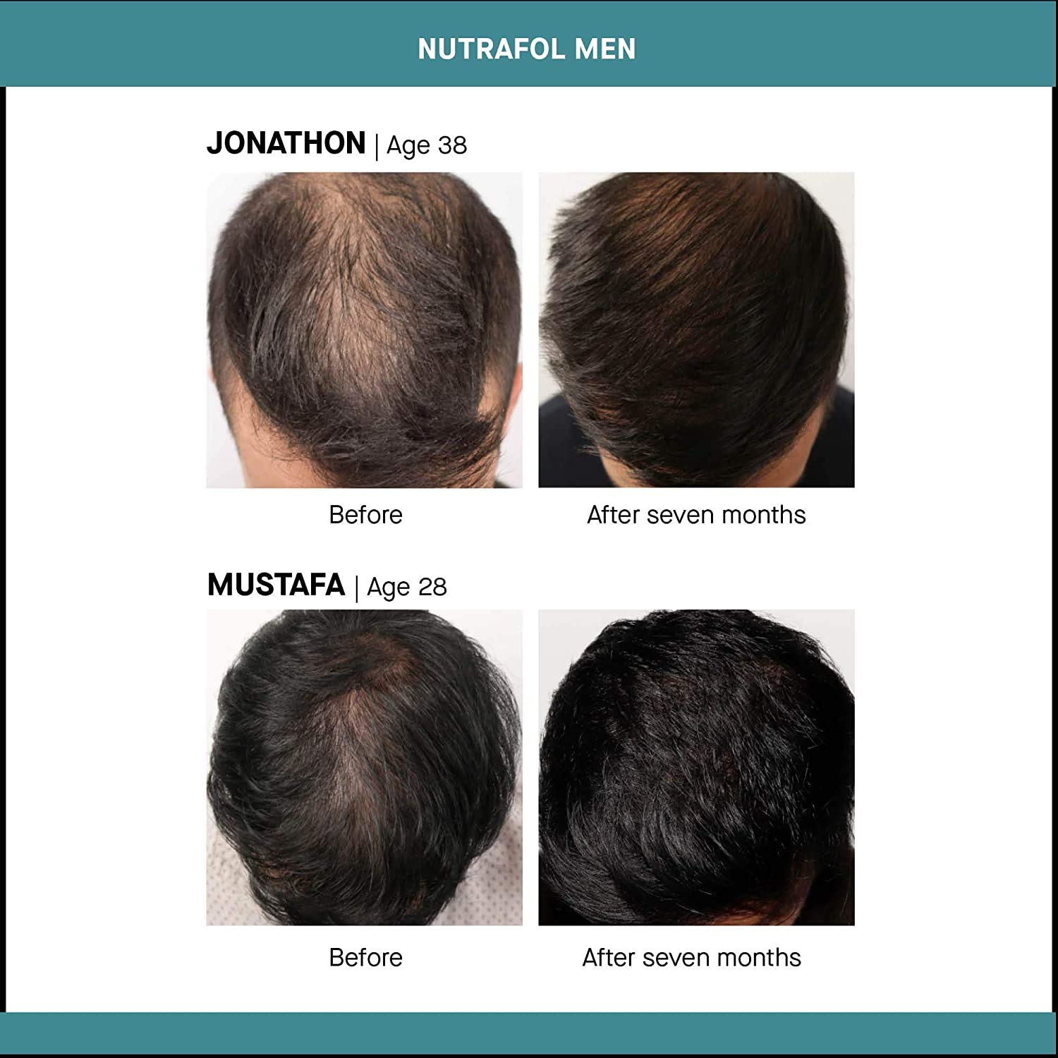 Nutrafol Mens Hair Growth Supplement - 3 Aylık Kür