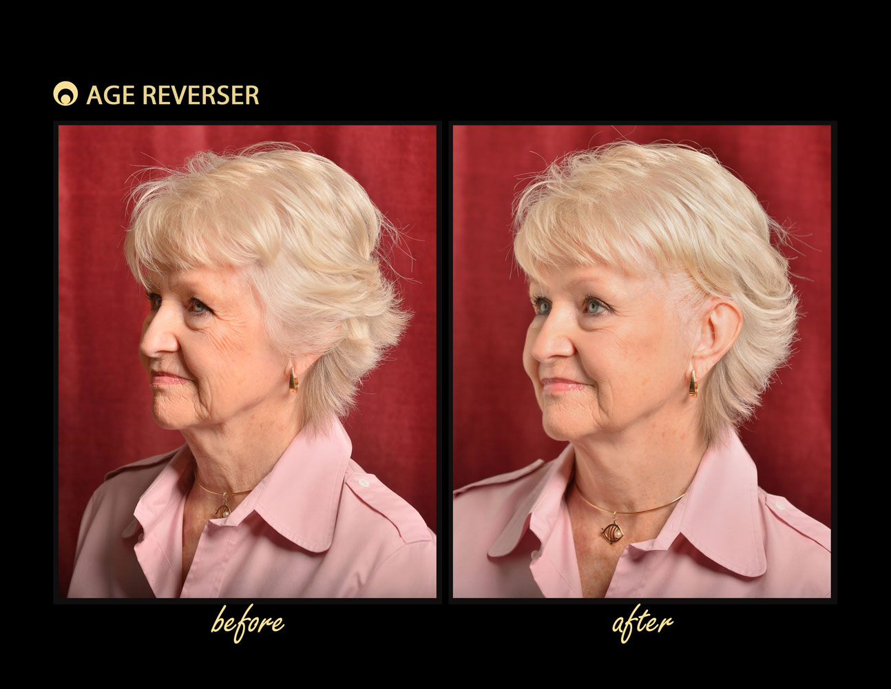 Age Reverser The Facelift Band