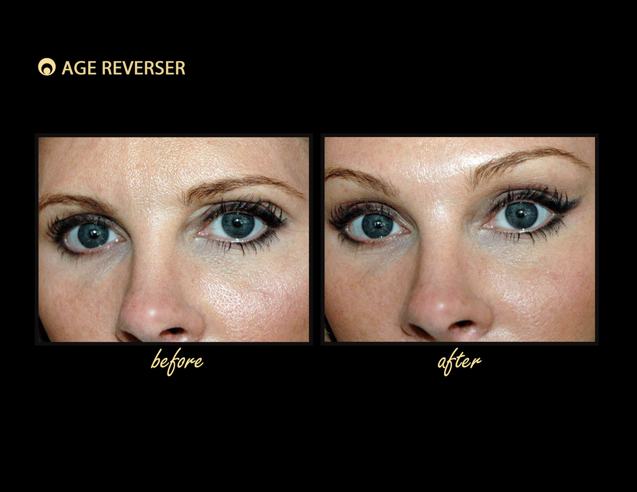 Age Reverser The Facelift Band