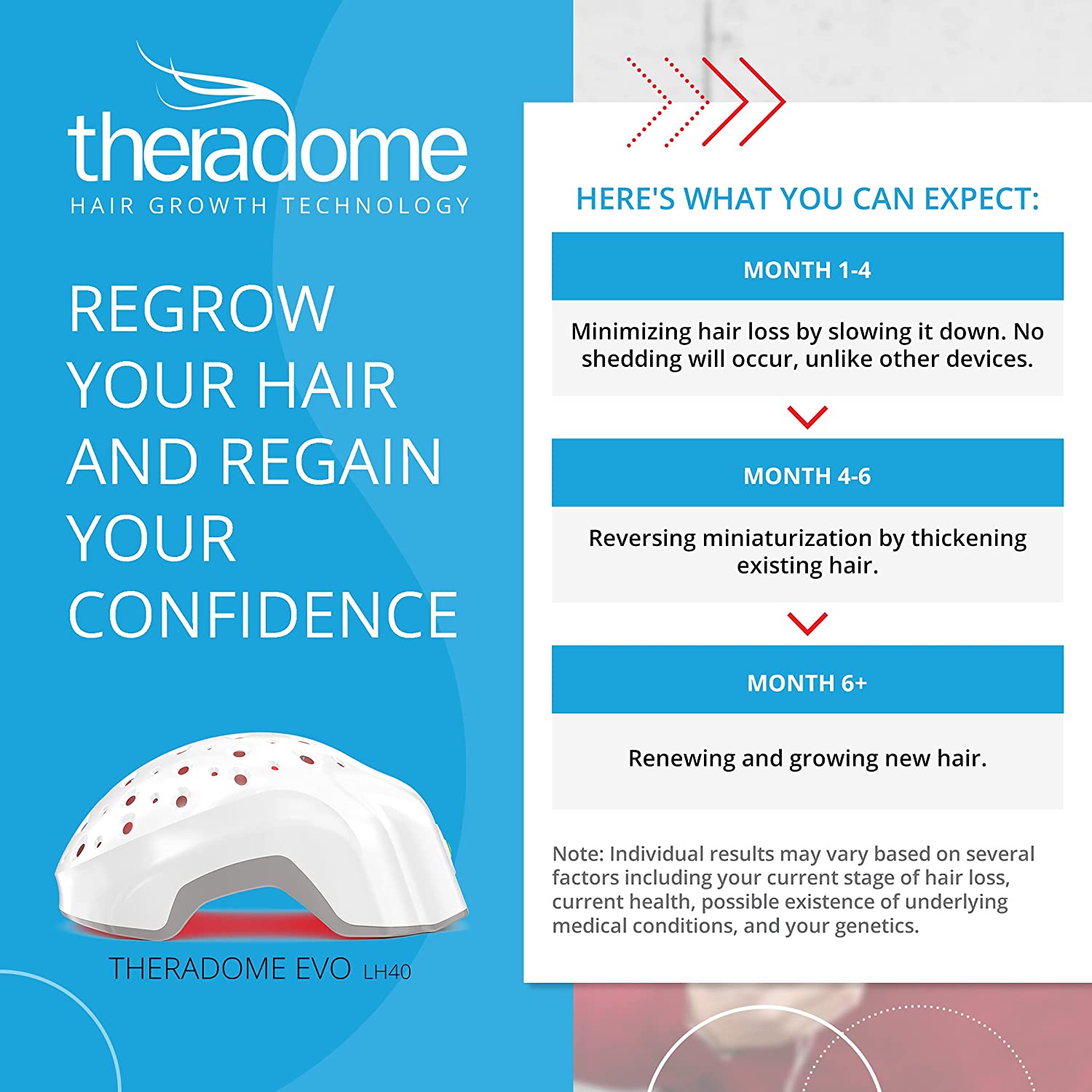 Theradome Laser Hair Growth Helmet LH40