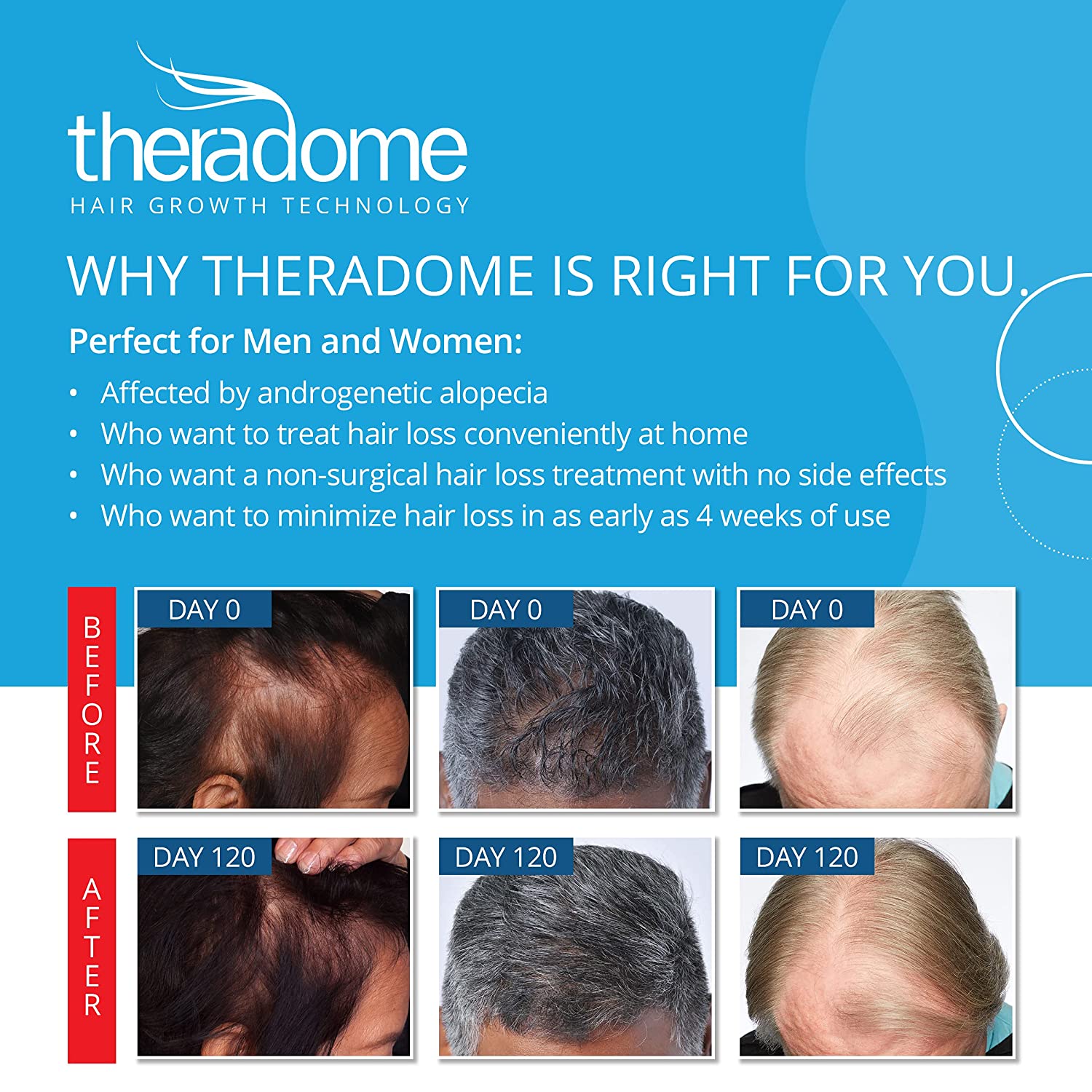 Theradome Laser Hair Growth Helmet LH40