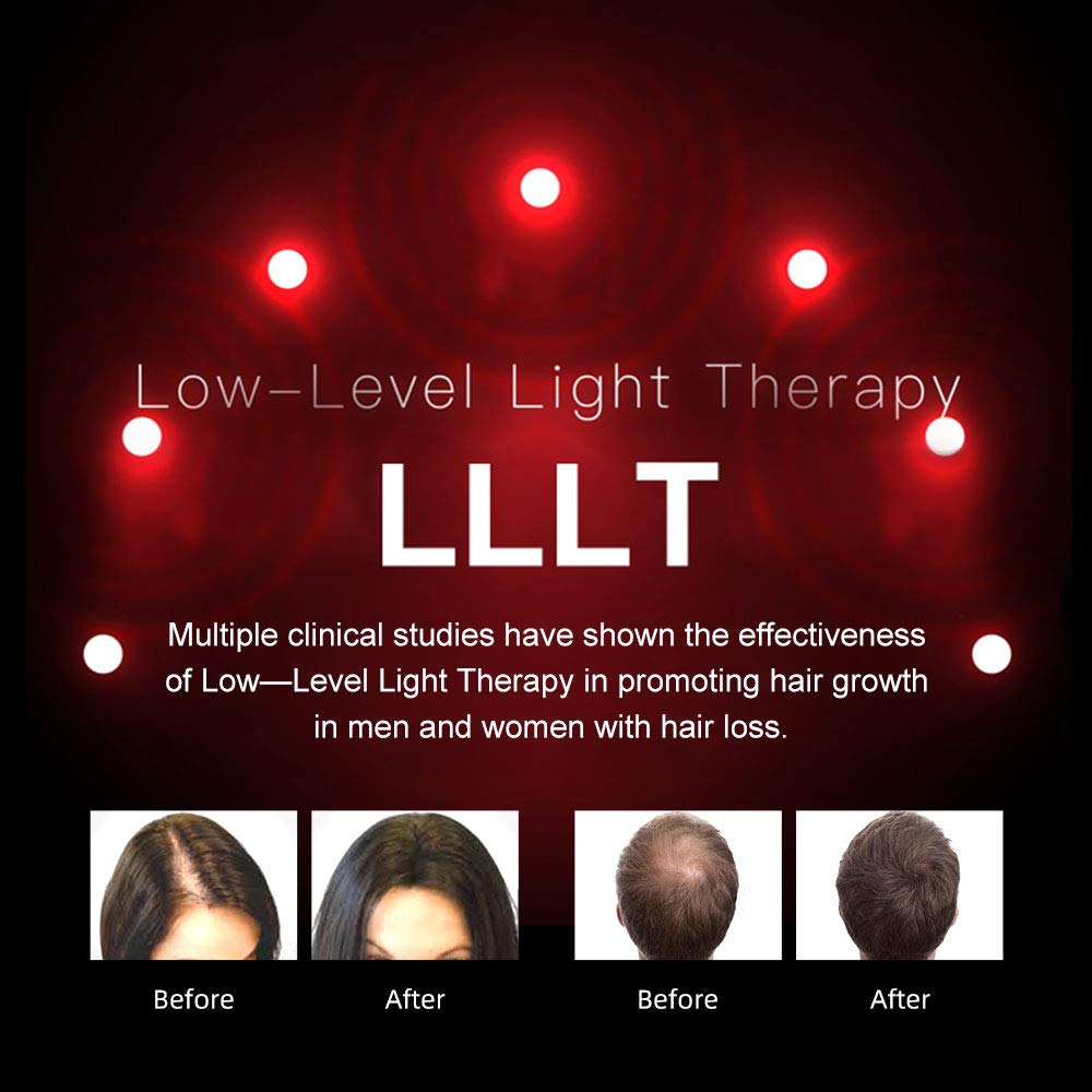 LESCOLTON Hair Growth System