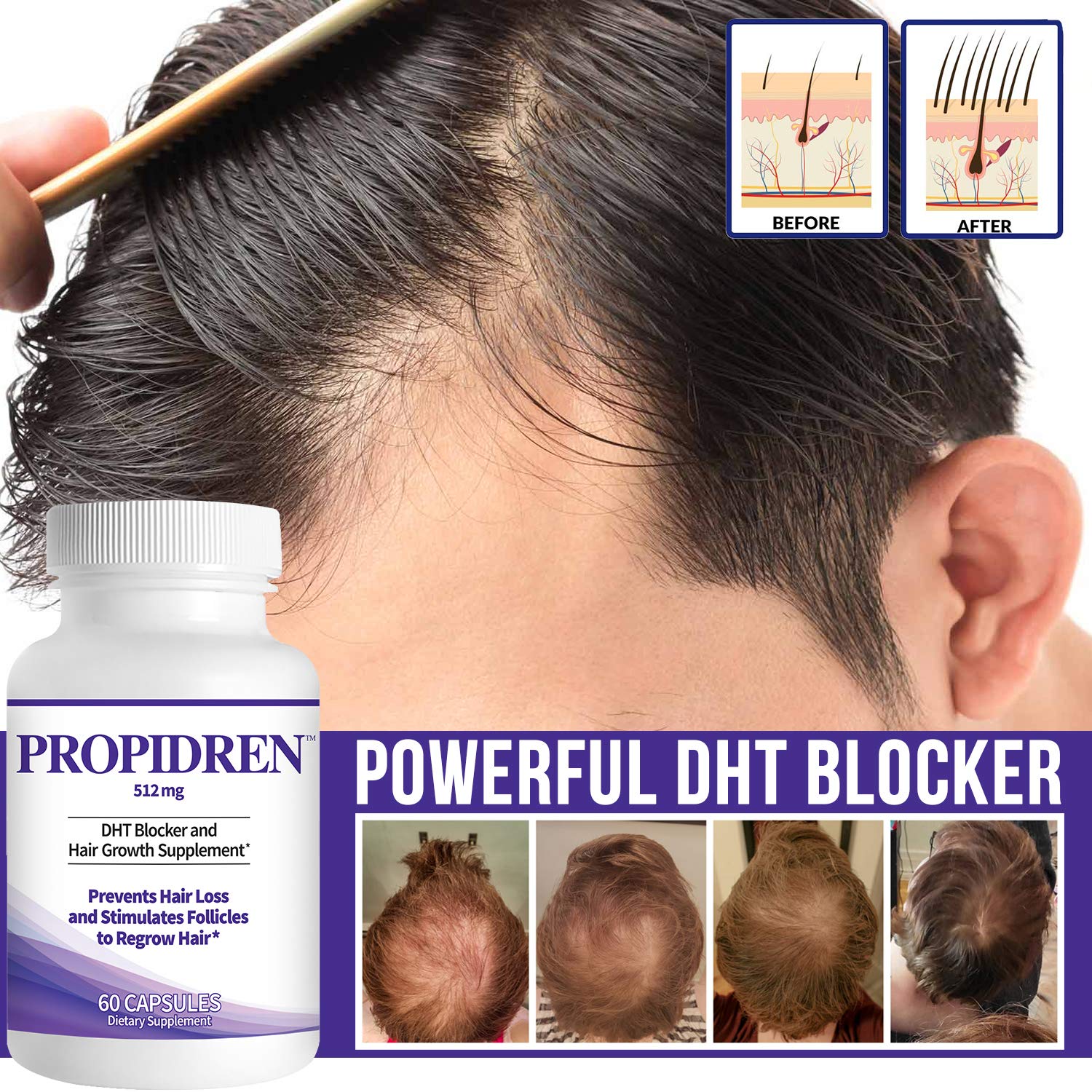 Propidren DHT Blocker and Hair Grow - 60 Tablet