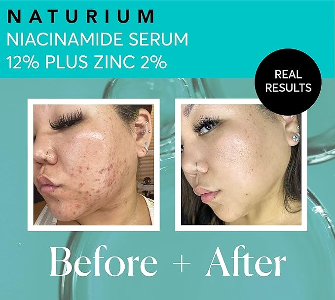 Naturium Niacinamide Face Serum 12% Plus Zinc 2% - 1 Oz