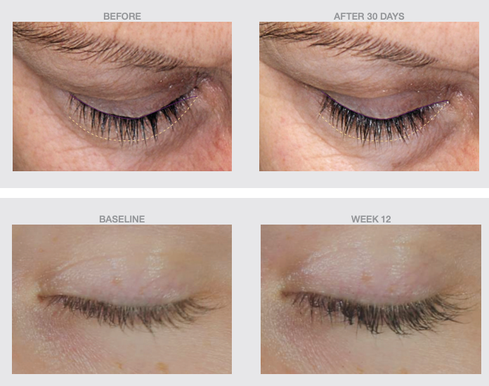 The Skin Spot Lash Boost Peptide Growth Lash/Brow Serum