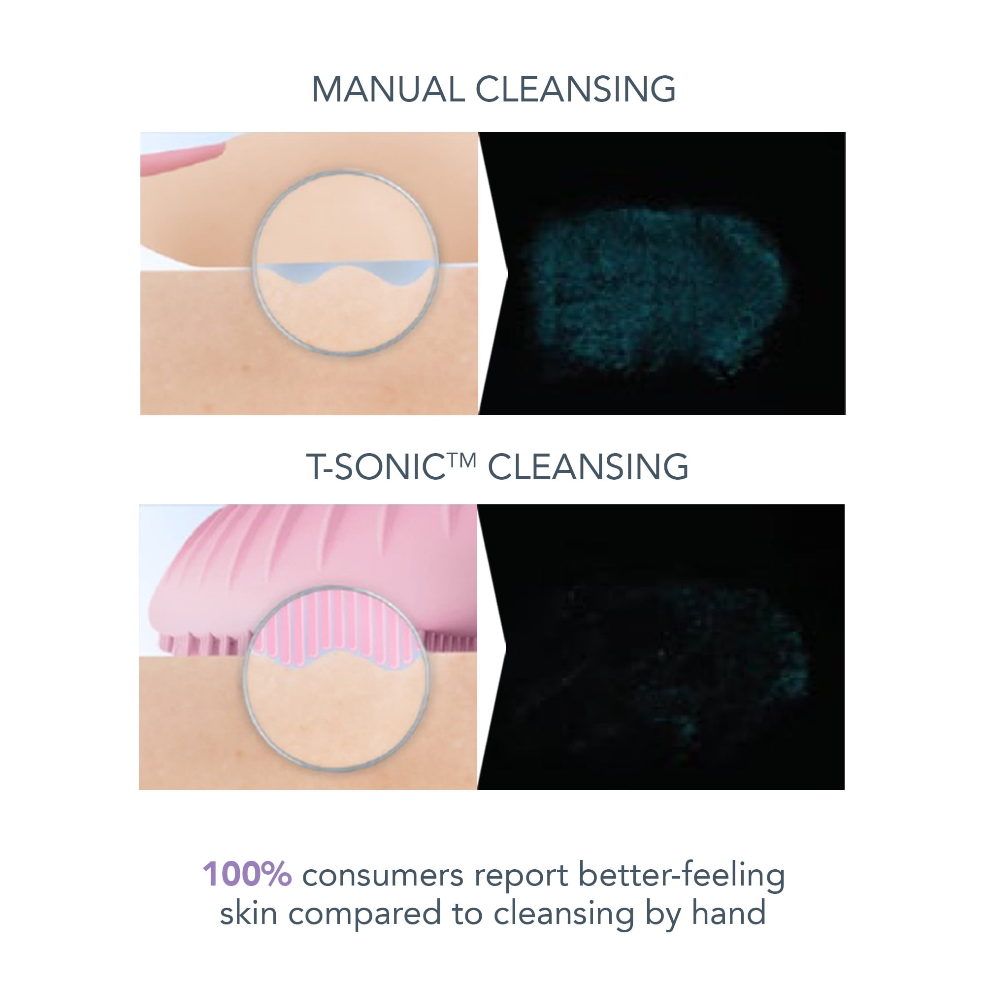 FOREO LUNA 3 Smart Sonic Facial Cleanser Massager Sensitive Skin Suitable