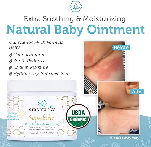Era Organic Healing Baby Ointment for Sensitive Skin - USDA Certified (4 oz.)