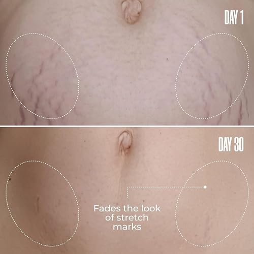 BIOGENESİS MAËLYS B-FLAT Belly Firming Cream - Stretch Mark & Tightening Formula