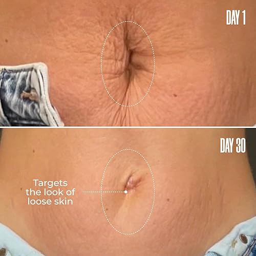 BIOGENESİS MAËLYS B-FLAT Belly Firming Cream - Stretch Mark & Tightening Formula