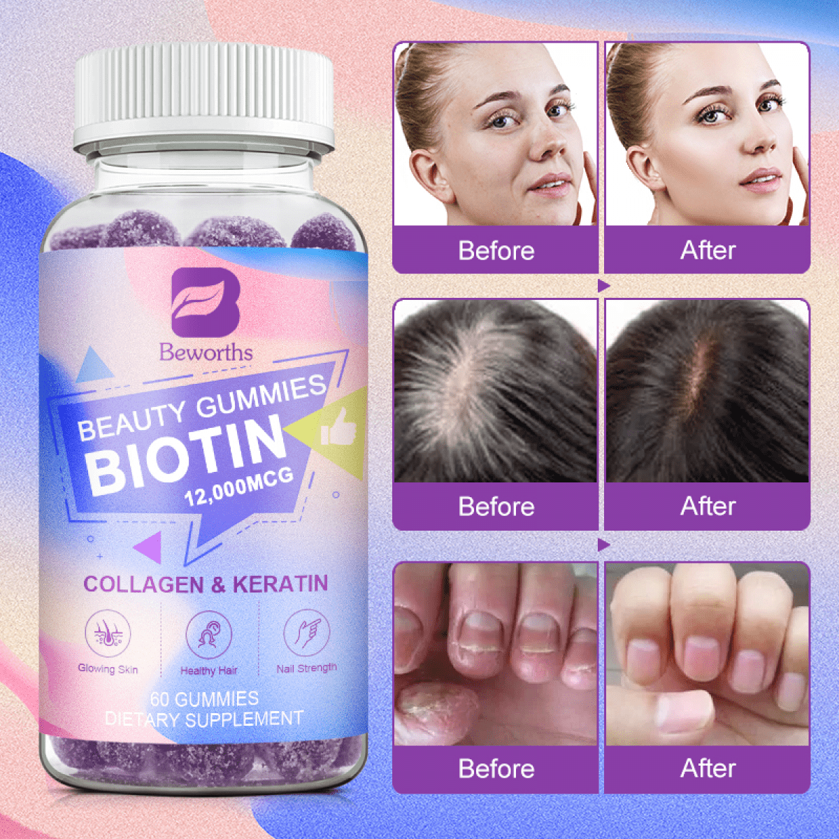Beworths Biotin Gummies 12000mcg for Hair, Skin & Nails, 60 Count with Collagen, Chlorophyll, Zinc - Vitamin Complex