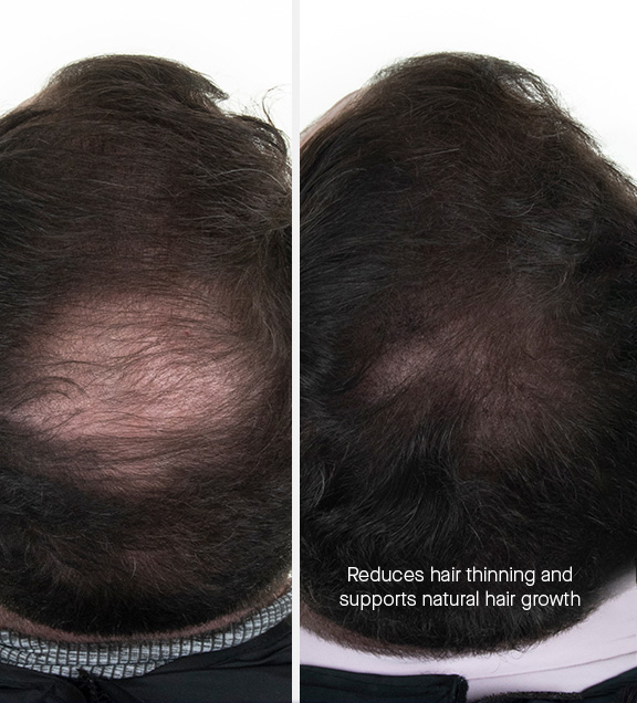 AUGUSTINUS BADER THE HAIR REVITALIZING COMPLEX