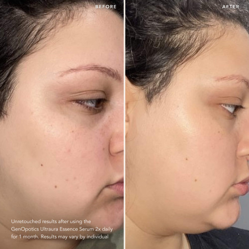 SK-II GENOPTICS ULTRAURA ESSENCE SERUM - BRIGHTENING SERUM