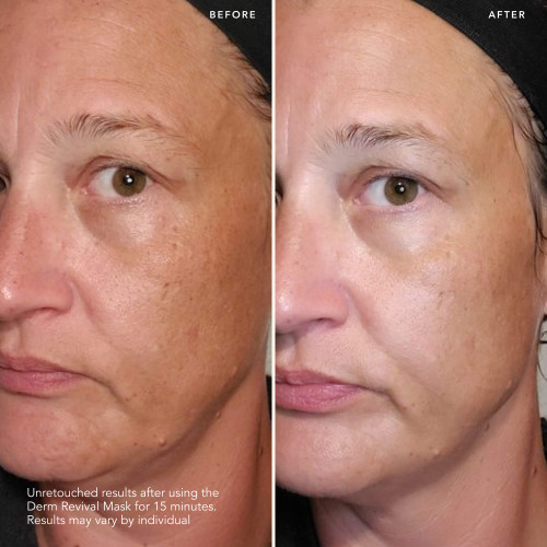 SK-II BRIGHTENING DERM REVIVAL MASK