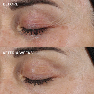 IMAGESKINCARE AGELESS+ RETINOL REPAIR CRèME 0.3% RETINOL COMPLEX (TRAVEL SIZE)