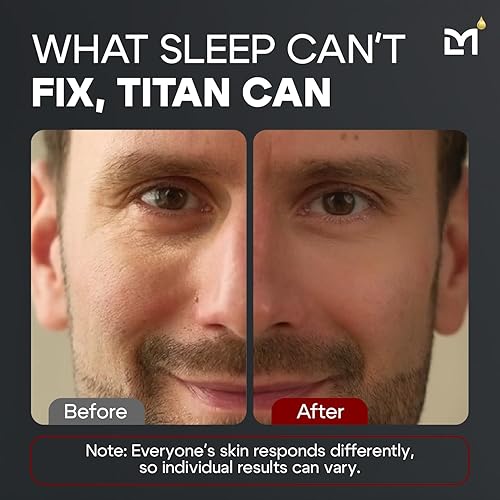 TITAN ANTI-AGING EYE CREAM FOR MEN DARK CIRCLES, PUFFINESS EYE BAGS TREATMENT UNSCENTED