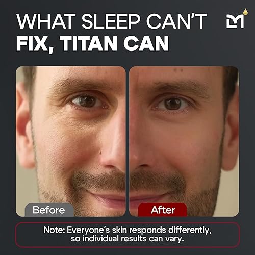 TITAN PEPTIDE COOLING EYE GEL FOR MEN ANTI-AGING, DARK CIRCLES PUFFY EYES TREATMENT