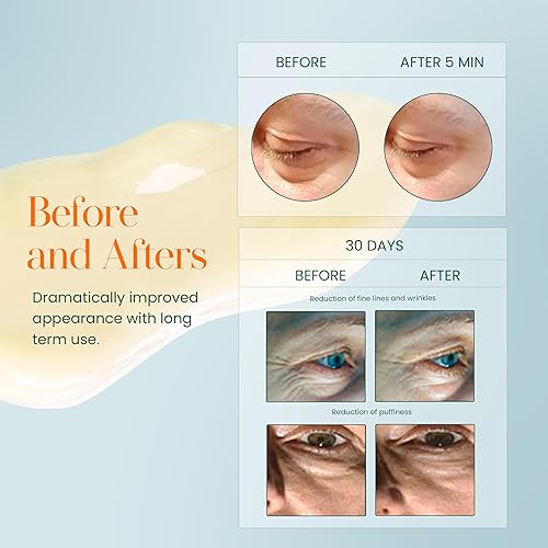 HYLUNIA INTENSIVE REPAIR EYE CREAM HYDRATING, FIRMING WITH PEPTIDES, VITAMIN C HYALURONIC ACID