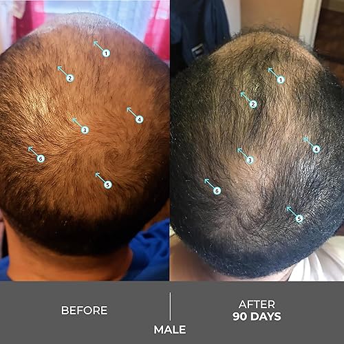 REVITA EXTRA STRENGTH SHAMPOO 205ML VOLUMIZING, THICKENING, SULFATE SILICONE FREE