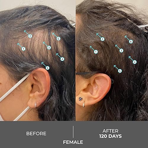 REVITA EXTRA STRENGTH SHAMPOO 205ML VOLUMIZING, THICKENING, SULFATE SILICONE FREE