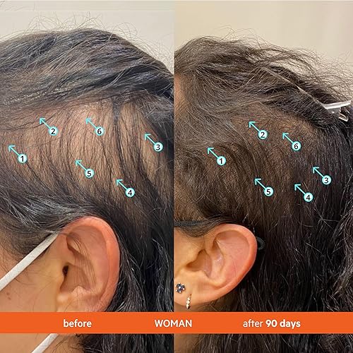 REVITA SHAMPOO 2-PACK 205ML VOLUMIZING, THICKENING, SULFATE SILICONE FREE