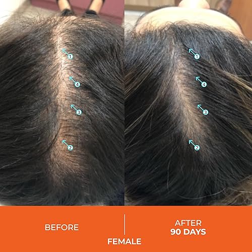 REVITA HAIR GUMMIES BIOTIN, ZINC MELATONIN FOR THICKER, STRONGER, VEGAN HAIR