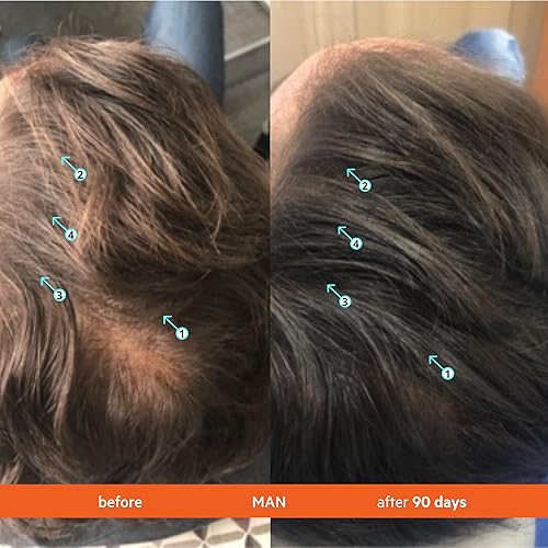 REVITA SHAMPOO VITAMIN TABLETS FOR THICKER HAIR GROWTH, DHT BLOCKER BIOTIN