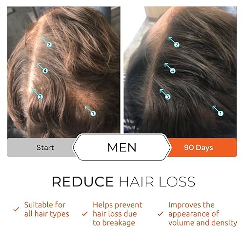 REVITA SHAMPOO 205ML HAIR VITAMINS TABLETS KIT VOLUMIZING, THICKENING HAIR CARE