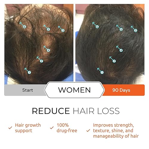 REVITA SHAMPOO 205ML HAIR VITAMINS TABLETS KIT VOLUMIZING, THICKENING HAIR CARE