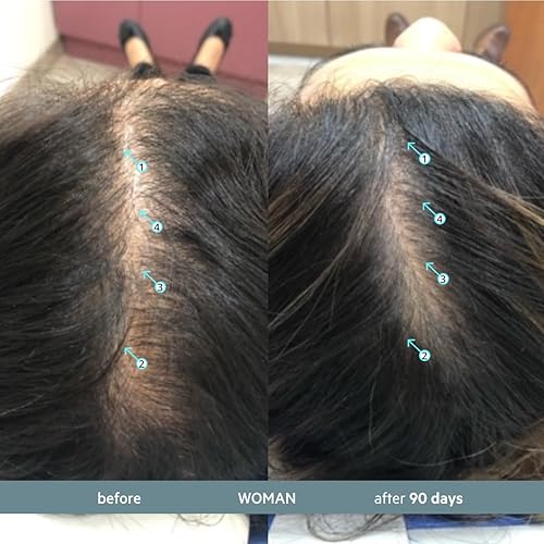 REVITA.SOD HAIR SUPPORT TABLETS ZINC, ASHWAGANDHA SOD FOR HAIR STRENGTH GROWTH