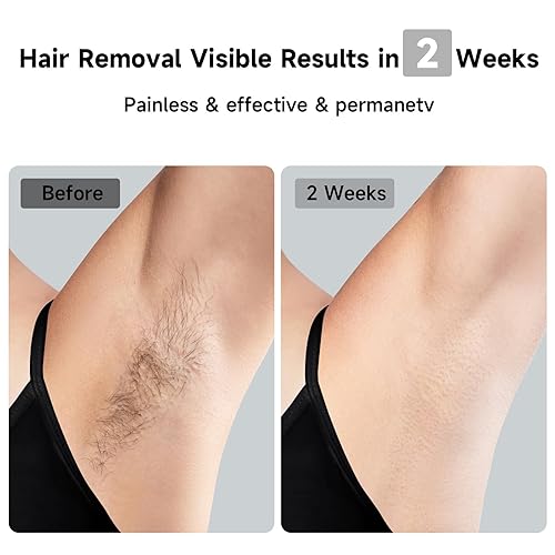 JOVS 3-IN-1 LASER HAIR REMOVAL DEVICE WITH SAPPHIRE COOLING, 8 MODES, TOUCHSCREEN FOR MEN WOMEN