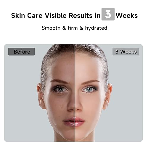 JOVS 3-IN-1 LASER HAIR REMOVAL DEVICE WITH SAPPHIRE COOLING, 8 MODES, TOUCHSCREEN FOR MEN WOMEN