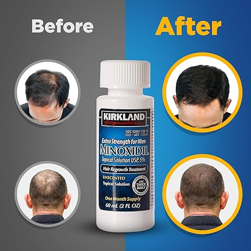 KIRKLAND SIGNATURE MINOXIDIL 5 FOR MEN HAIR REGROWTH - 1 MONTH SUPPLY, EFFECTIVE TREATMENT