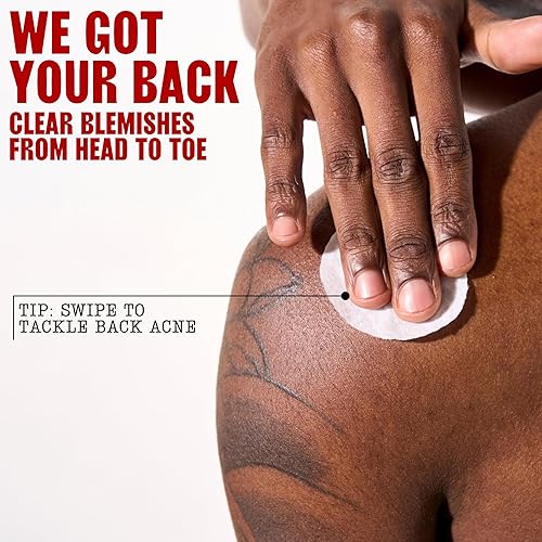 THAYERS ACNE PADS WITH SALICYLIC ACID WITCH HAZEL BLEMISH CLEARING, EXFOLIATING, 60 CT