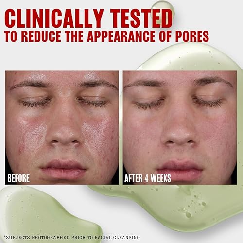 THAYERS OIL BALANCING COOLING JELLY TONER FOR OILY SKIN, PORE-REDUCING, HYDRATING 12OZ