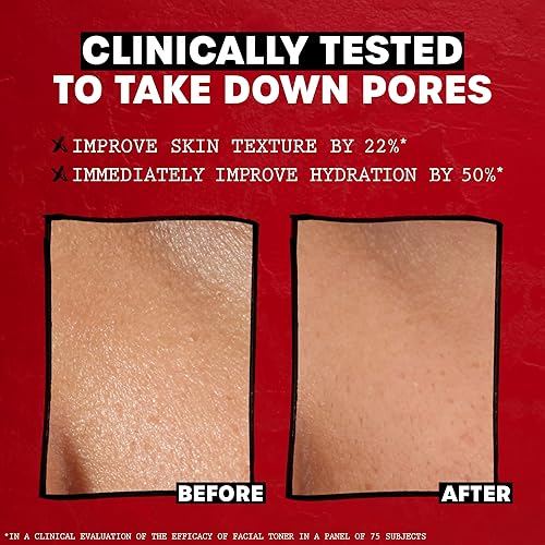 THAYERS ALCOHOL-FREE CUCUMBER WITCH HAZEL TONER WITH ALOE VERA, HYDRATING, VEGAN, 12 OZ