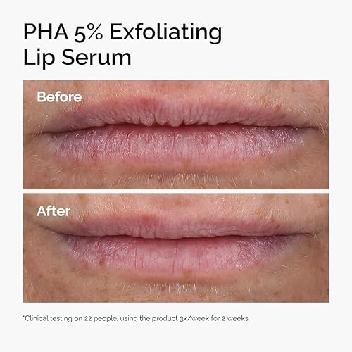 THE ORDINARY PHA 5 EXFOLIATING LIP SERUM HYDRATING OVERNIGHT LIP TREATMENT, 0.5 FL OZ