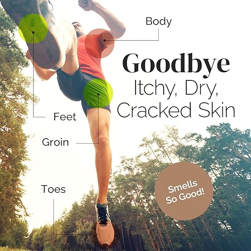 PURIYA EXTRA STRENGTH TEA TREE OIL BALM FOR JOCK ITCH, ATHLETES FOOT, RINGWORM, FAST RELIEF FOR ITCHY SKIN