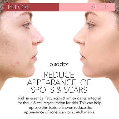 PURA DOR ORGANIC ROSEHIP SEED OIL 4OZ 100 PURE, COLD PRESSED, ANTI-AGING, SCAR STRETCH MARK TREATMENT