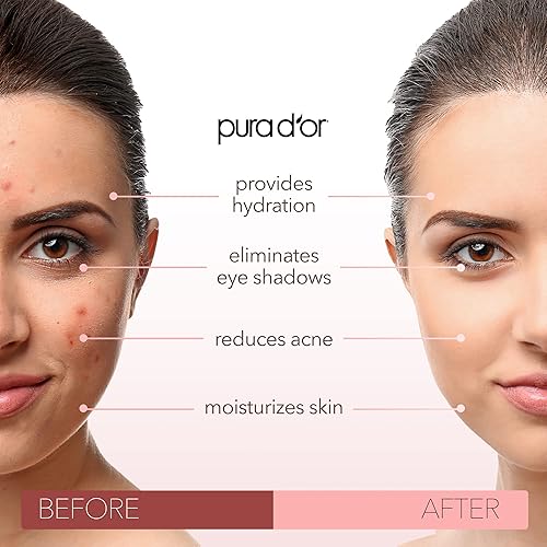 PURA D OR ORGANIC SWEET ALMOND OIL 16OZ 100 PURE COLD PRESSED CARRIER OIL FOR HAIR SKIN