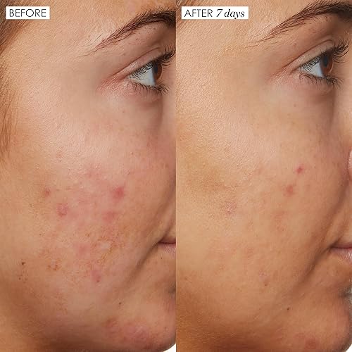 SUNDAY RILEY B3 NICE 10 NIACINAMIDE SERUM FOR FACE, BRIGHTENING PORE CARE, 1.0OZ