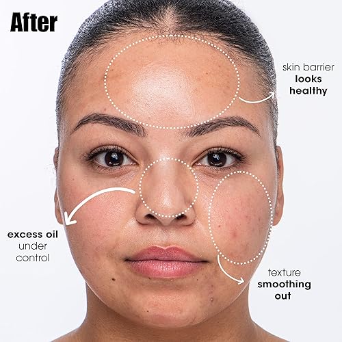 SUNDAY RILEY SALICYLIC ACID CLEANSER FOR ACNE BLEMISH-PRONE SKIN BREAKOUT BREAKUP FACE WASH