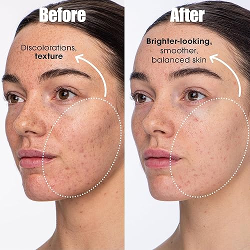 SUNDAY RILEY DETOX DARLING BALANCING ESSENCE MIST FOR OILY, ACNE-PRONE BLEMISH-PRONE SKIN OIL CONTROL