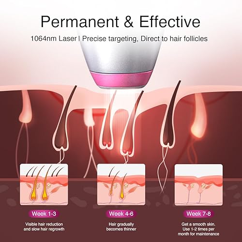DERMRAYS 1064NM DIODE LASER HAIR REMOVAL FOR DARK MELANATED SKIN, PERMANENT REDUCTION