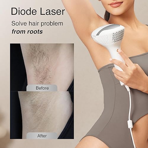 DERMRAYS V8S FDA-CLEARED 810NM DIODE LASER HAIR REMOVAL DEVICE FOR MEN WOMEN SKIN TONE 1-5