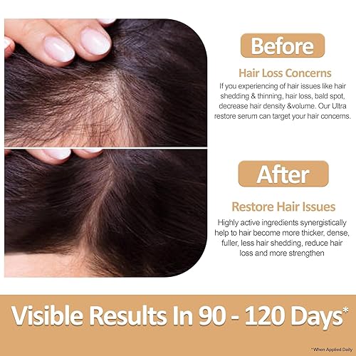 NIRVANA NURTURE ULTRA RESTORE HAIR GROWTH SERUM WITH STEM CELLS, BIOTIN ASHWAGANDHA FOR FULLER HAIR SCALP HEALTH